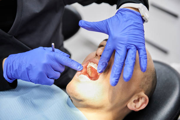 Best Emergency Dental Care for Broken or Chipped Teeth in New Orleans, LA